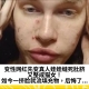 变性网红先变真人娃娃缝死肚脐，又整成猫女！如今一挤脸就流填充物，后悔了...