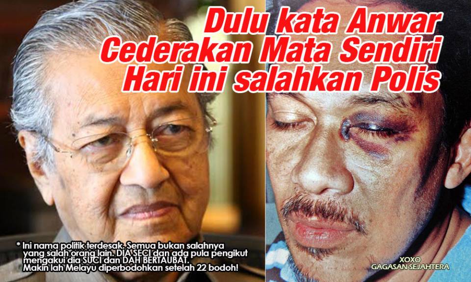 anwar lebam.jpg