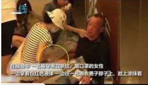 假傷.JPG