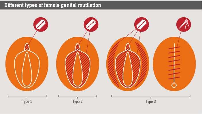 tahap-FGM.jpg