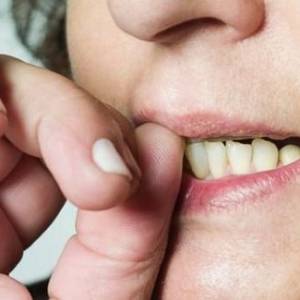 赶快戒掉咬指甲的习惯！ 腐蚀皮肤影响健康