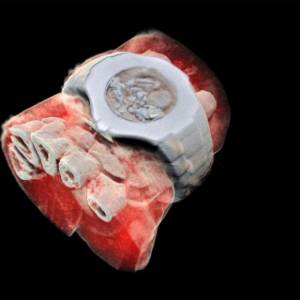 外科手术革命时代到来！首张人体3D彩色X光片曝光！
