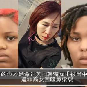黑人的命才是命？美国韩裔女「被当中国人」　遭非裔女围殴鼻梁裂