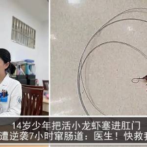 14岁少年把活小龙虾塞进肛门　遭逆袭7小时窜肠道：医生！快救我