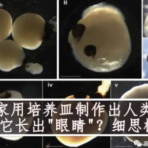 科学家用培养皿制作出人类大脑，还让它长出