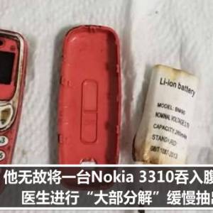 他无故将一台Nokia 3310吞入腹内　医生进行“大部分解”缓慢抽出