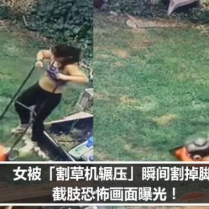 女被「割草机辗压」瞬间割掉脚趾　截肢恐怖画面曝光！