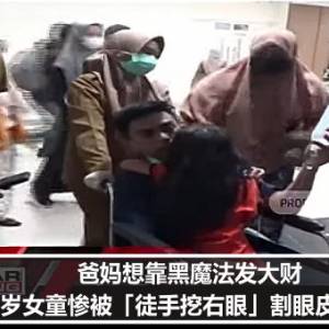 爸妈想靠黑魔法发大财　6岁女童惨被「徒手挖右眼」割眼皮食用