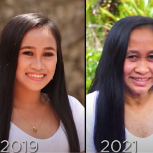 16岁菲律宾少女迅速衰老成60岁老人的脸，寻遍医生后找出了心酸病因...