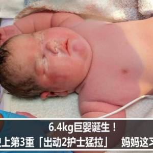 6.4kg巨婴诞生！英国史上第3重「出动2护士猛拉」　妈妈这习惯造成