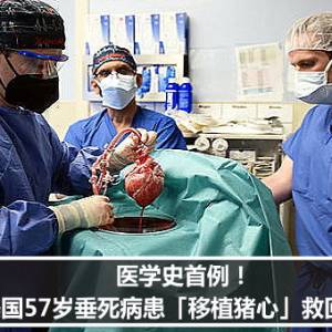 医学史首例！　美57岁垂死病患「移植猪心」救回来了