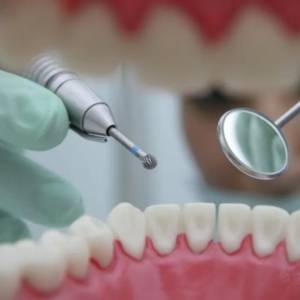 美国牙医故意钻坏病人的牙齿再做修复手术，5年毁掉上千颗牙，赚取数百万！