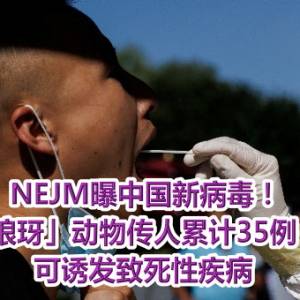 NEJM曝中国新病毒！「琅玡」动物传人累计35例　可诱发致死性疾病