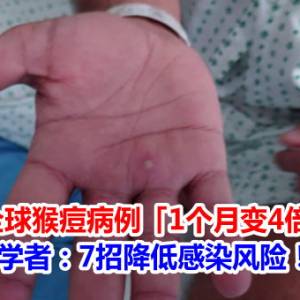 全球猴痘病例「1个月变4倍」　学者：7招降低感染风险！