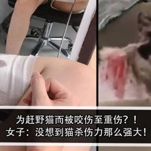 为赶野猫而被咬伤至重伤？！女子：没想到猫杀伤力那么强大！