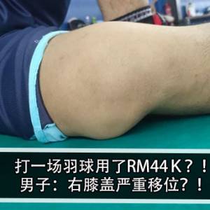 打一场羽球用了RM44Ｋ？！男子：右膝盖严重移位？！