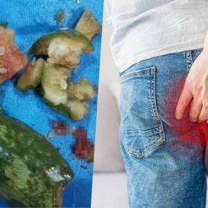 整颗菜瓜“从菊花入体”取不出来！　25岁男解释：洗菜滑倒坐进去！