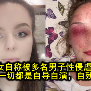 少女自称被多名男子性侵虐待，如今被曝一切都是自导自演，自残捏造真相