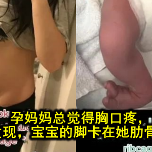 孕妈妈总觉得胸口疼，生完才发现，宝宝的脚卡在她肋骨里了？！