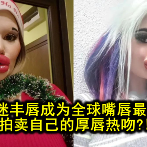 女子痴迷丰唇成为全球嘴唇最厚网红，拍卖自己的厚唇热吻?!