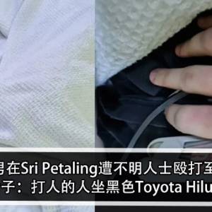 17岁男在Sri Petaling遭不明人士殴打至昏迷！女子：打人的人坐黑色Toyota Hilux！