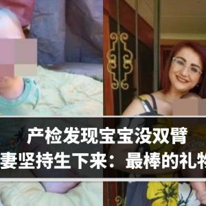 产检发现宝宝没双臂　夫妻坚持生下来：最棒的礼物！