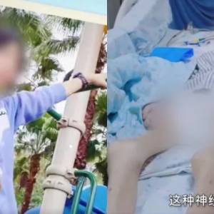 少女为男神减肥近50天只喝水　送院时体重不足25kg...器官衰竭逝世