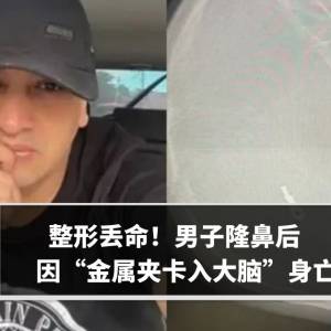 整形丢命！男子隆鼻后　因“金属夹卡入大脑”身亡