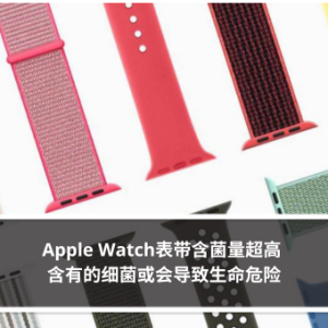 Apple Watch表带含菌量超高 含有的细菌或会导致生命危险