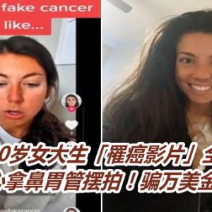 20岁女大生「罹癌影片」全是假　开心拿鼻胃管摆拍！骗万美金善款