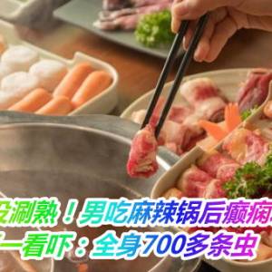 肉没涮熟！男吃麻辣锅后癫痫发作　医一看吓：全身700多条虫