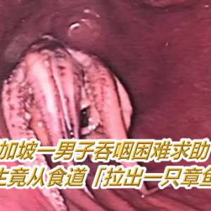 新加坡一男子吞咽困难求助！　医生竟从食道「拉出一只章鱼」