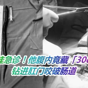 肚子痛爆挂急诊！他腹内竟藏「30cm活鳗鱼」　钻进肛门咬破肠道