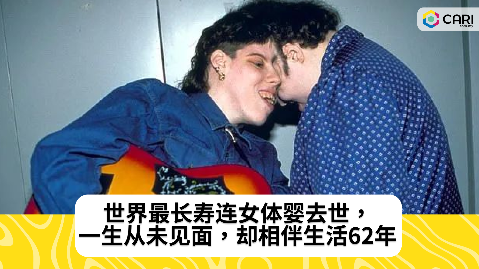 世界最长寿连女体婴去世，一生从未见面，却相伴生活62年