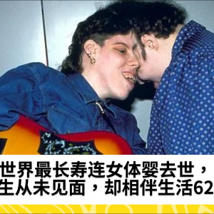 世界最长寿连女体婴去世，一生从未见面，却相伴生活62年