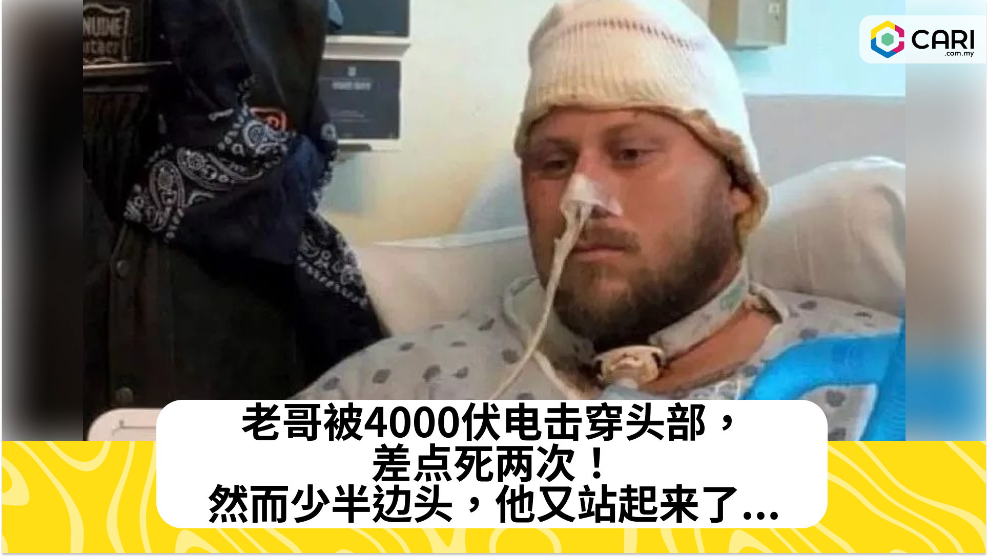 老哥被4000伏电击穿头部，差点死两次！然而少半边头，他又站起来了...