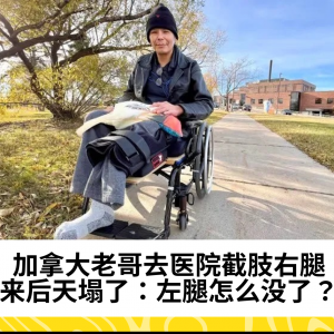 加拿大老哥去医院截肢右腿，醒来后天塌了：左腿怎么没了？！