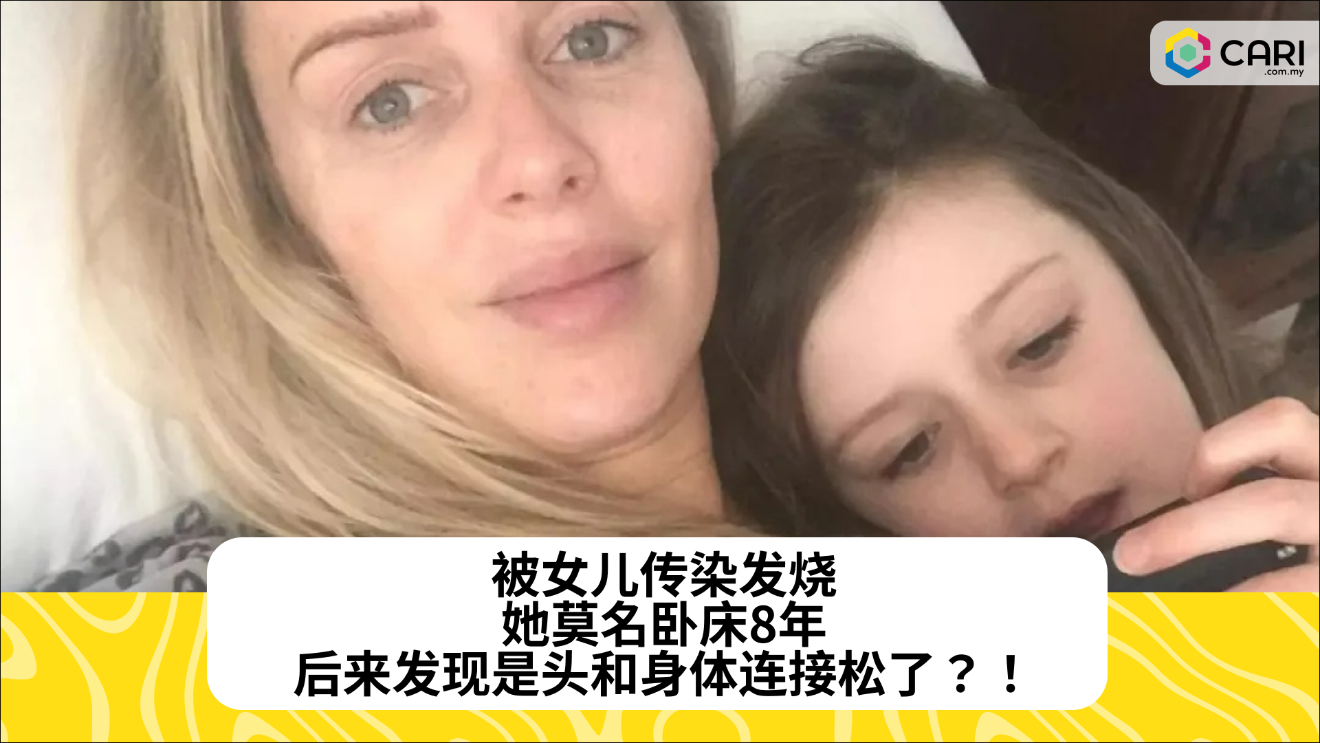 被女儿传染发烧，她莫名卧床8年，后来发现是头和身体连接松了？！