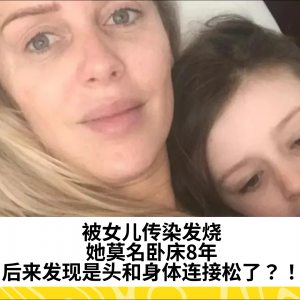 被女儿传染发烧，她莫名卧床8年，后来发现是头和身体连接松了？！