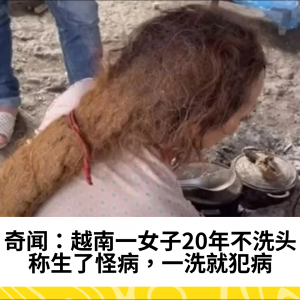 奇闻：越南一女子20年不洗头，称生了怪病，一洗就犯病