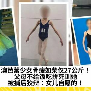 澳芭蕾少女骨瘦如柴仅27公斤！父母不给饭吃拼死训她，被捕后狡辩：女儿自愿的！