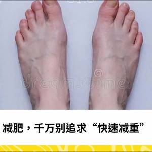 减肥，千万别追求“快速减重”