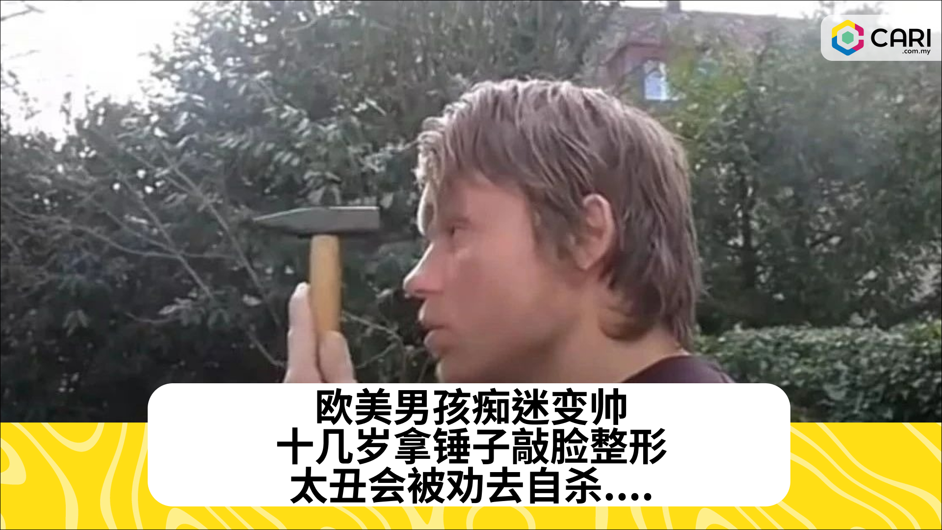 欧美男孩痴迷变帅，十几岁拿锤子敲脸整形，太丑会被劝去自杀....