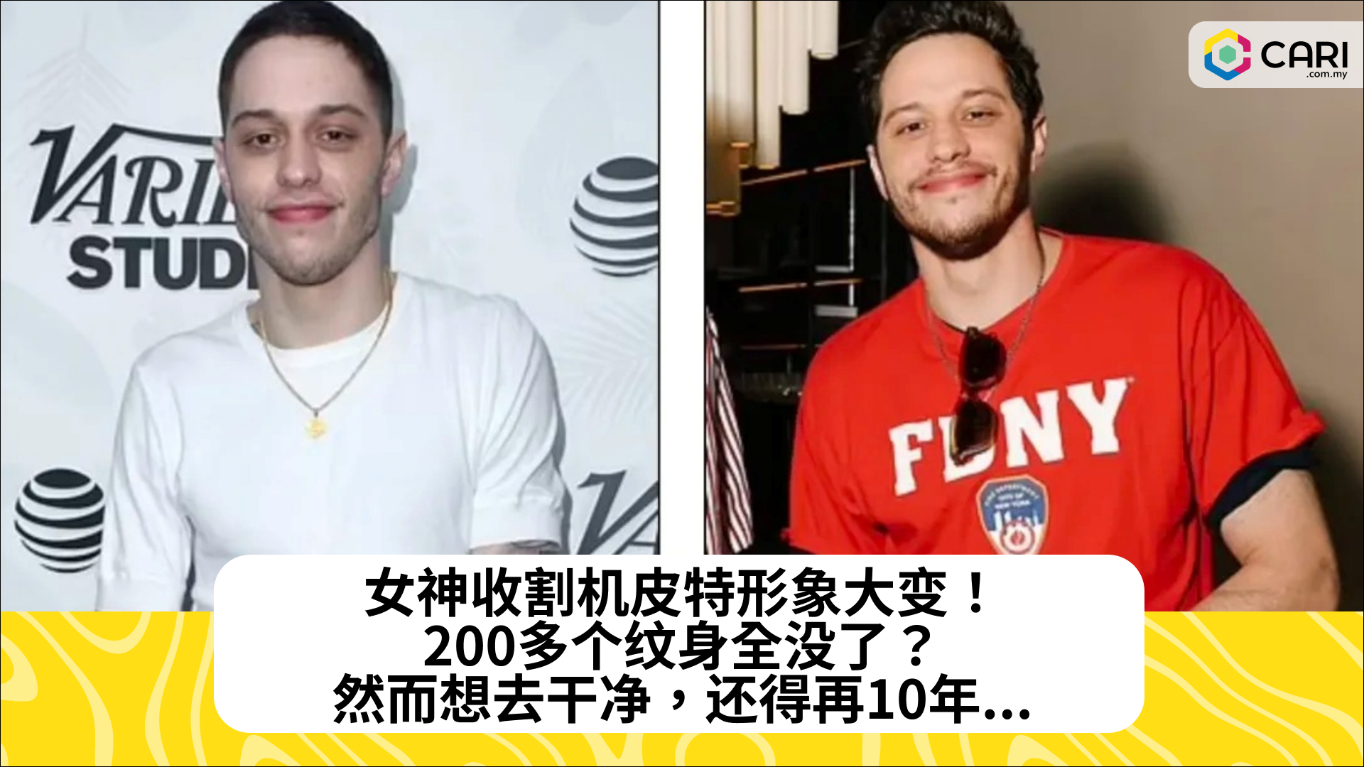 女神收割机皮特形象大变！200多个纹身全没了？然而想去干净，还得再10年...