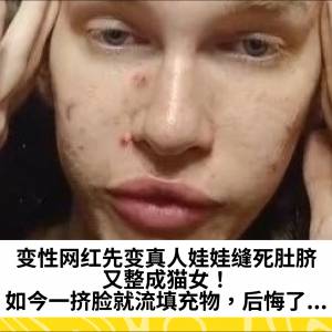 变性网红先变真人娃娃缝死肚脐，又整成猫女！如今一挤脸就流填充物，后悔了...