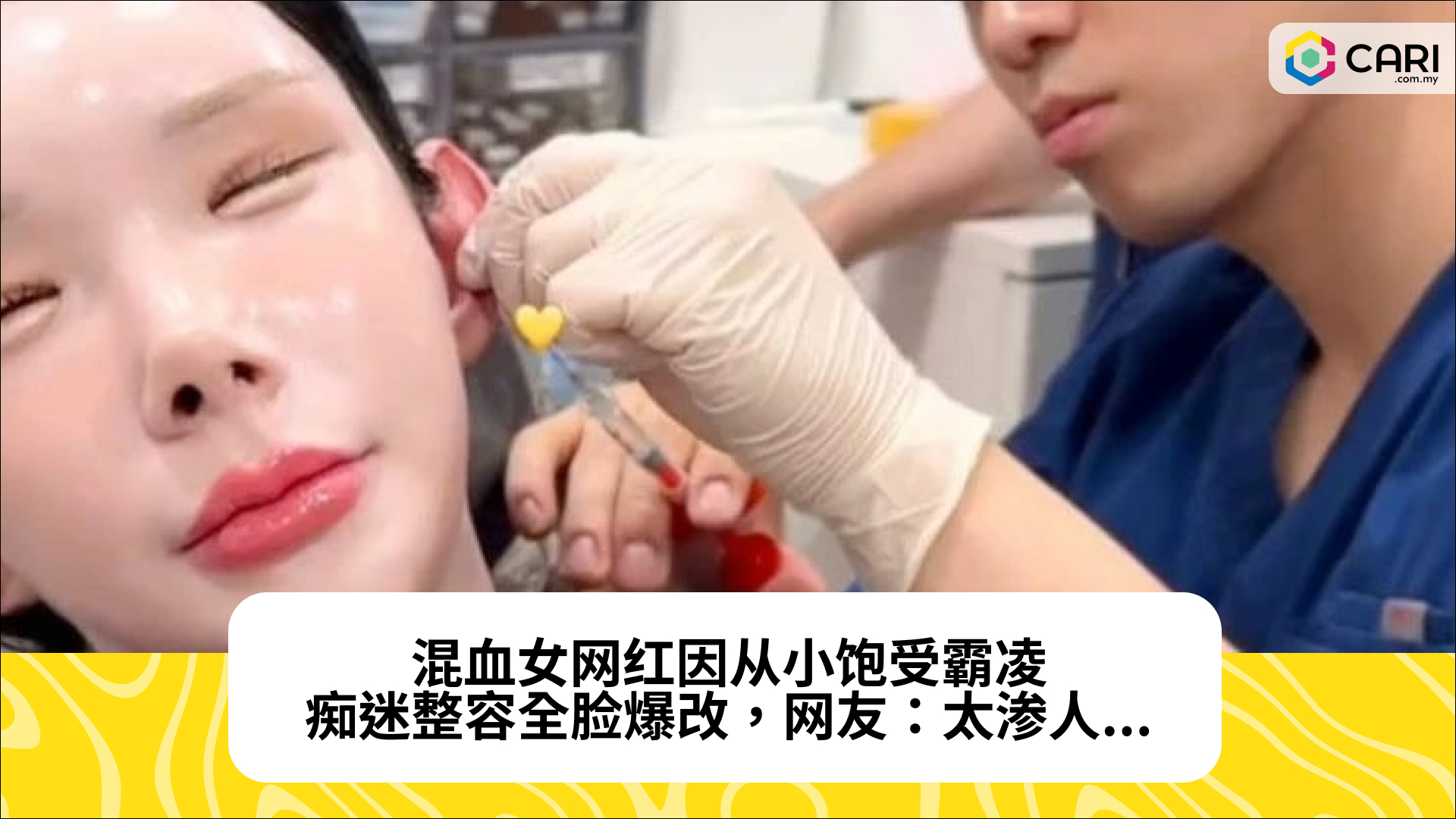混血女网红因从小饱受霸凌，痴迷整容全脸爆改，网友：太渗人...