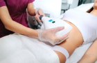 Is fat freezing weight loss treatment right for you?