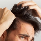 Hair Transplant Treatment: Restoring Your Hair and Confidence