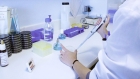 Industrial Enzyme Manufacturing Plant Project Report 2024