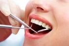 A Brighter Smile Starts with Dental Fillings
